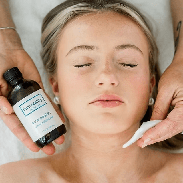 Face Reality Acne Clearing Package at Esthetics With Candise in Omaha, NE