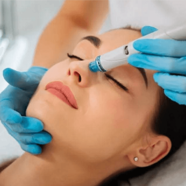Deluxe HydraFacial Package at Esthetics With Candise in Omaha, NE